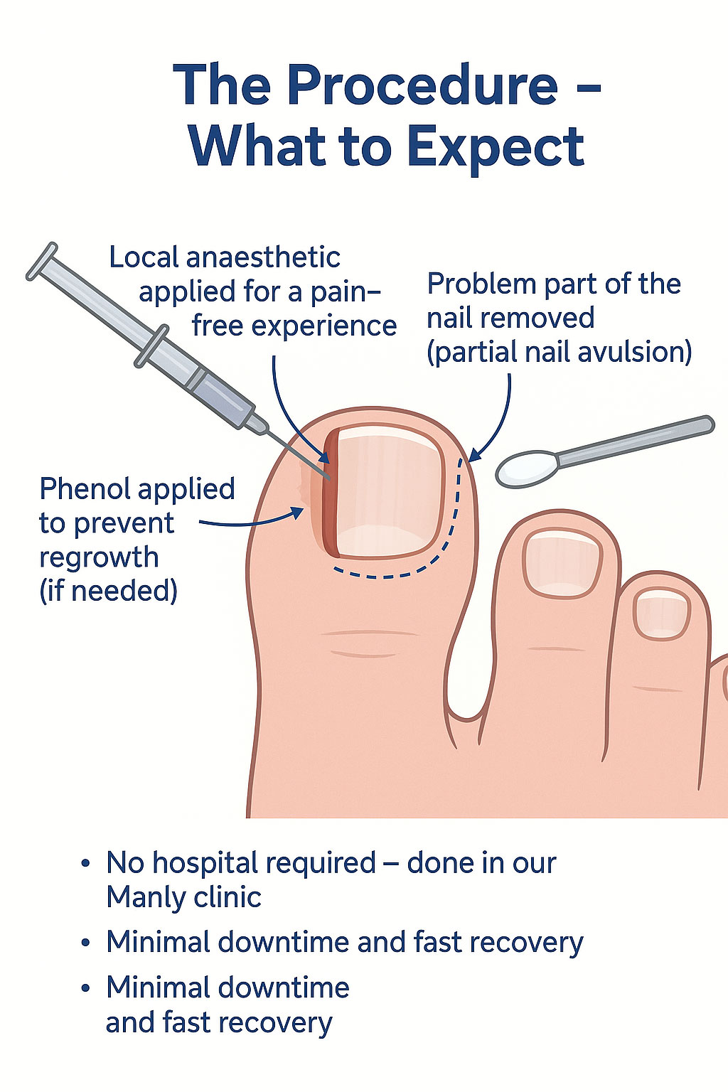 The-procedure